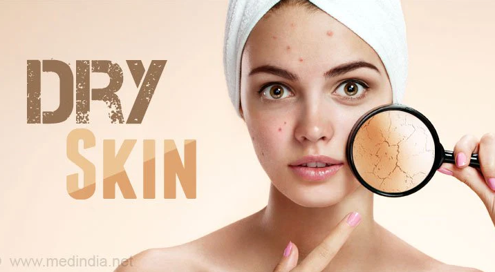 Effective Dry Skin Remedies: Say Goodbye to Dryness and Hello to Radiant Skin!